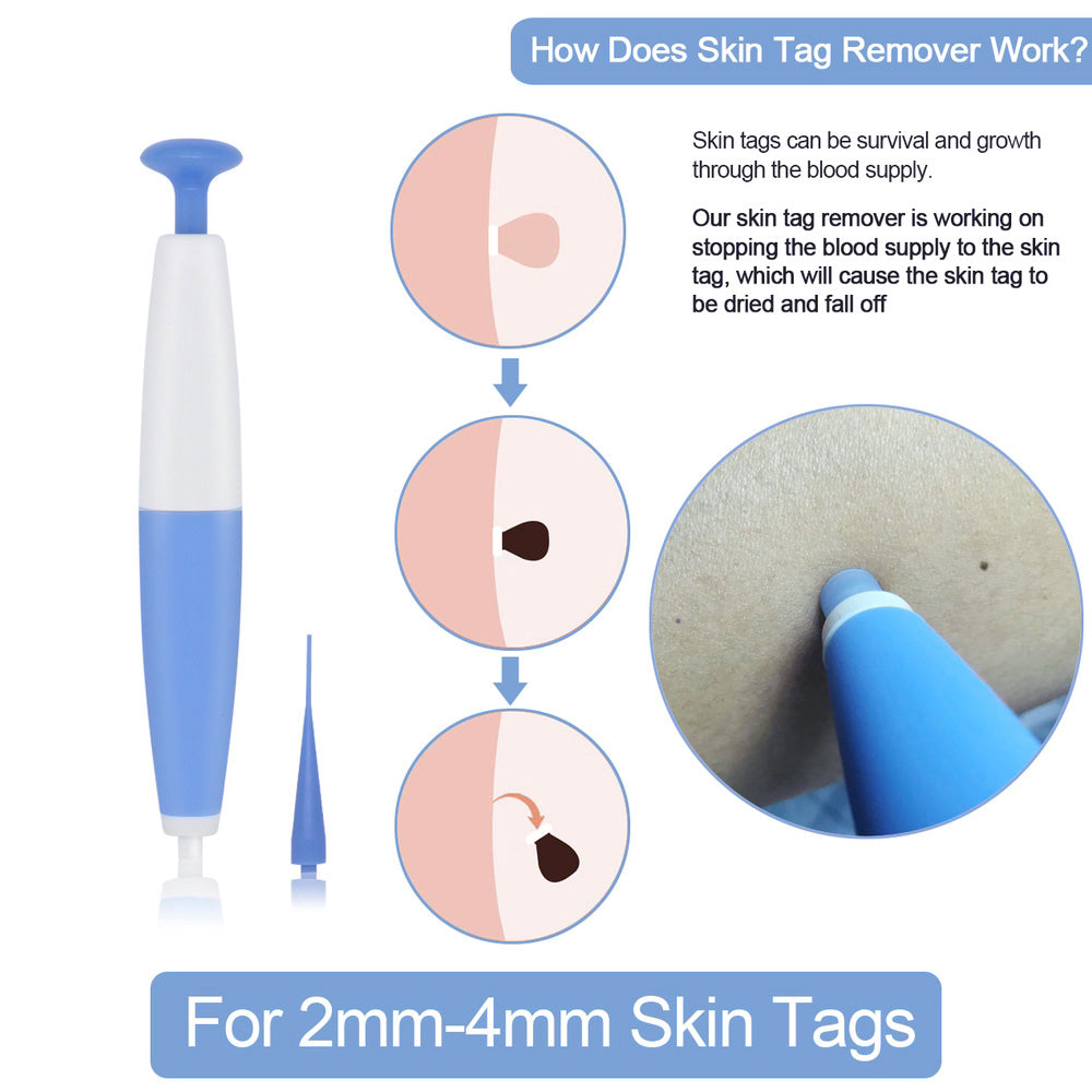 Skin Tag Removal Kit Home Use Mole Wart Remover Micro Band Skin Tag Treatment Tool Easy To Clean Skin Care Tool